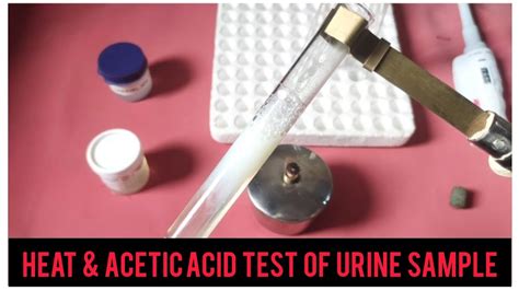 heat and acetic acid test|Acetic ACID TEST .